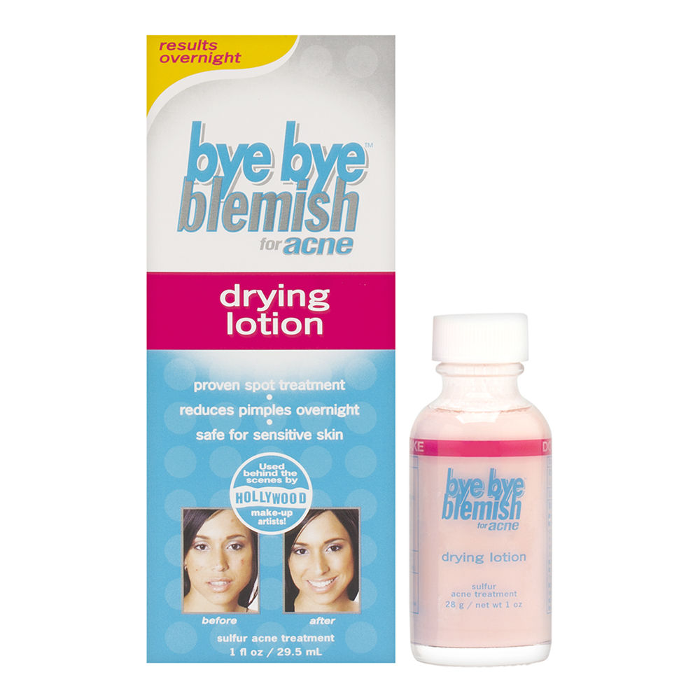 Bye Bye Blemish for Acne Drying Lotion 29.5ml/1oz